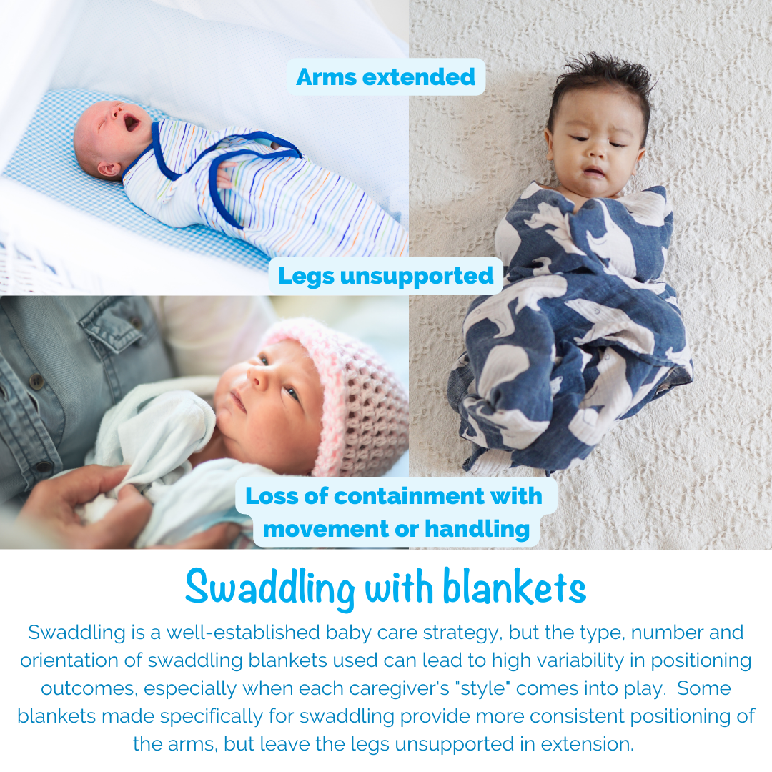 Swaddling With Blankets: Arms extended, legs unsupported, loss of containment with movement or handling. Swaddling is a well-established baby care strategy, but the type, number, and orientation of swaddling blankets used can lead to high variability in positioning outcomes, especially when each caregiver's "style" comes into play. Some blankets made specifically for swaddling provide more consistent positioning of the arms, but leave the legs unsupported in extension.
