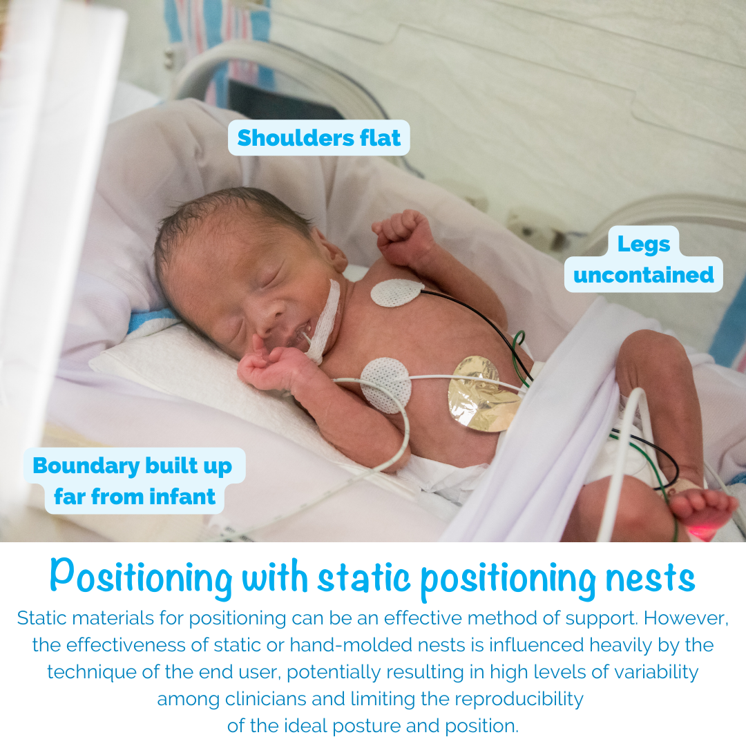Positioning With Static Positioning Nests: (Shoulders Flat, Legs Uncontained, Boundary Built Up Far From Infant) Static materials for positioning can be an effective method of support. However, the effectiveness of static or hand-molded nests is influenced heavily by the technique of the end user, potentially resulting in high levels of variability among clinicians and limiting the reproducibility of the ideal posture and position.