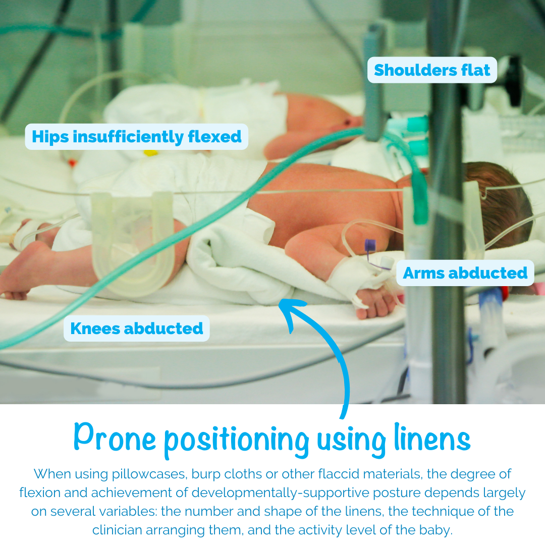 Prone Positioning Using Linens: (Shoulders flat, Hips insufficiently flexed, Arms abducted, Knees abducted) When using pillowcases, burp cloths, or other flaccid materials, the degree of flexion and achievement of developmentally supportive posture depends largely on several variables: the number and shape of the linens, the technique of the clinician arranging them, and the activity level of the baby.